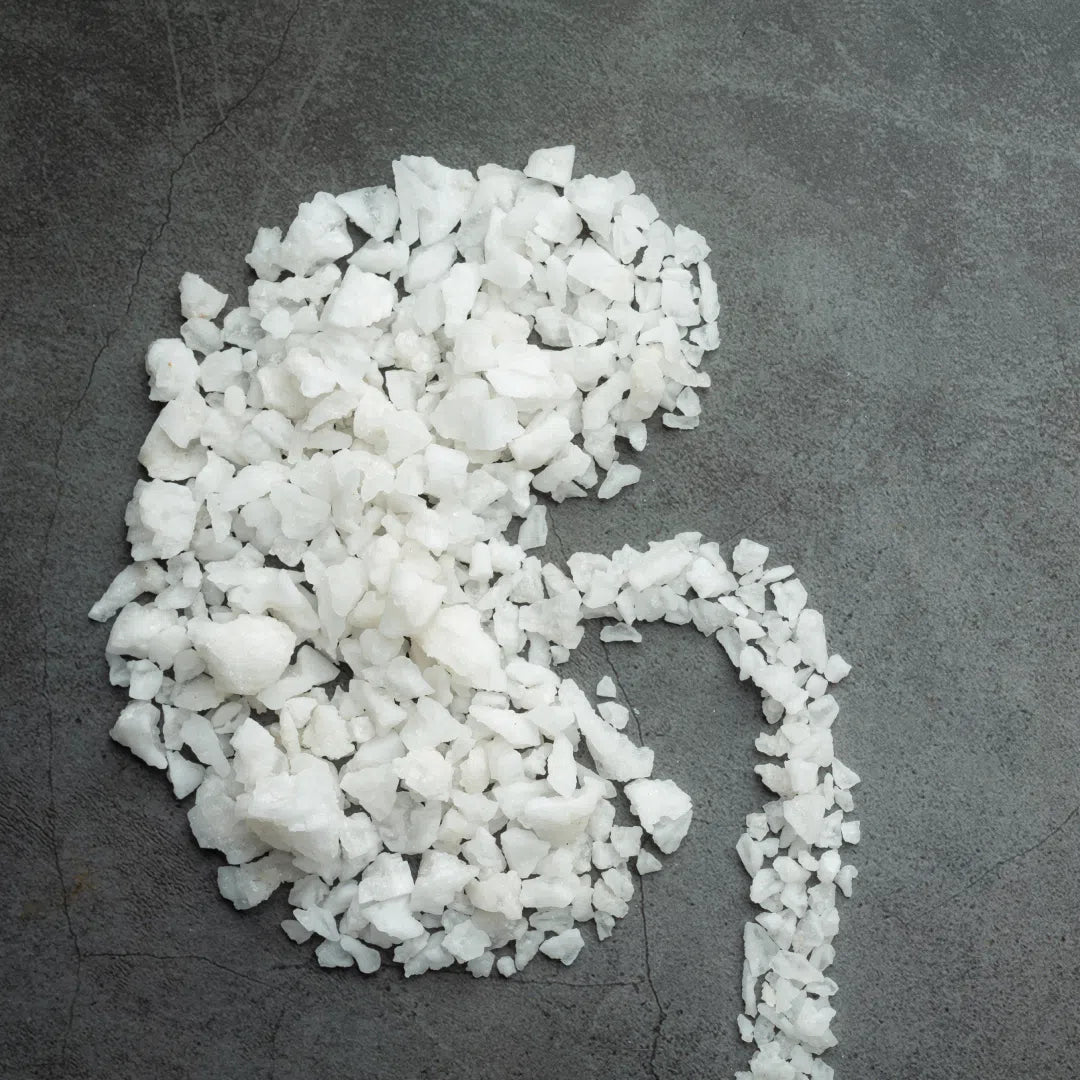 Kidney Stone