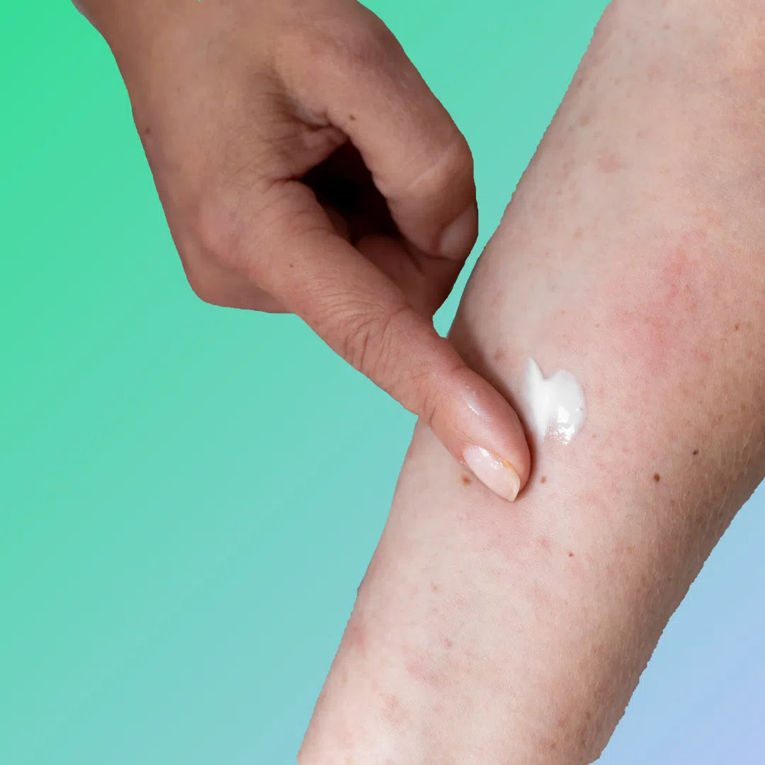 Scabies