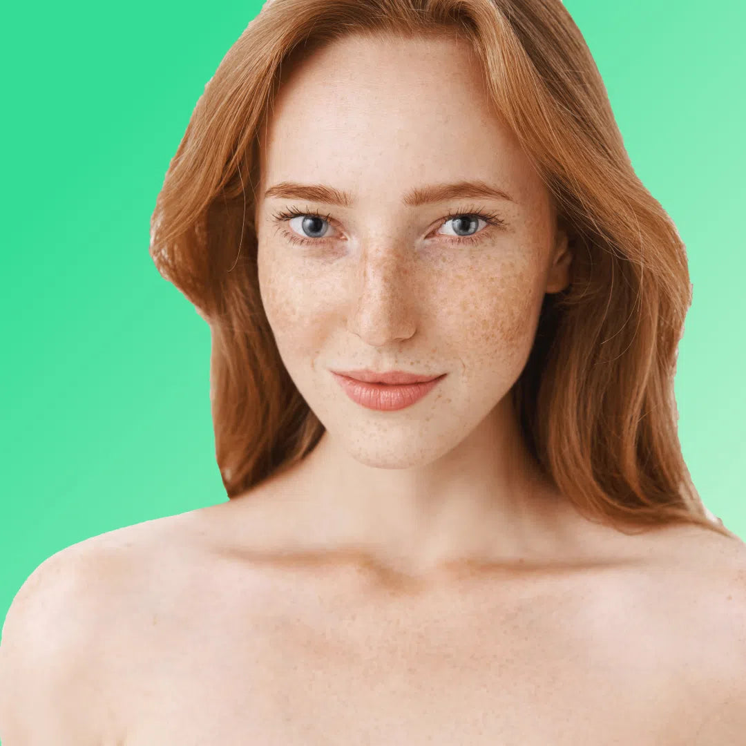 Skin Pigmentation