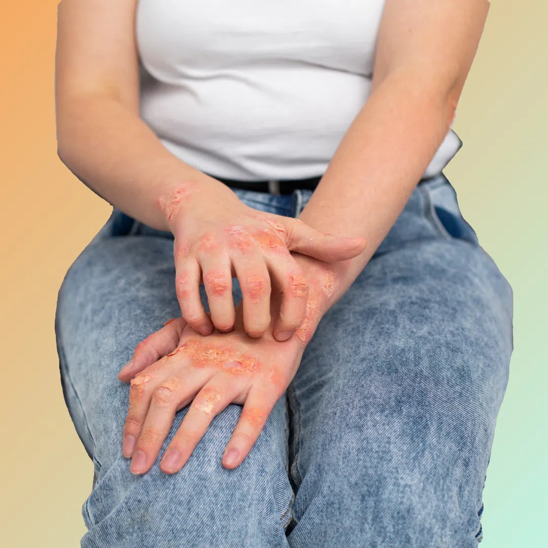 Wounds & Insects Bites